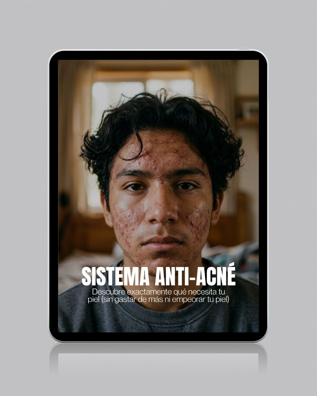 sistema antiacne rutina completa para eliminar granos y controlar grasa