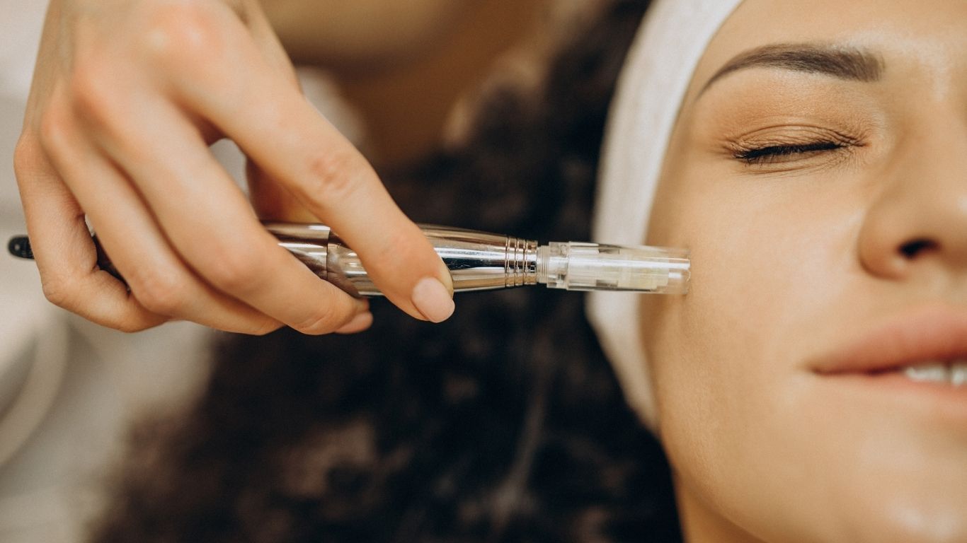 Dermapen facial: qué es, cómo funciona y por qué transforma la piel desde adentro