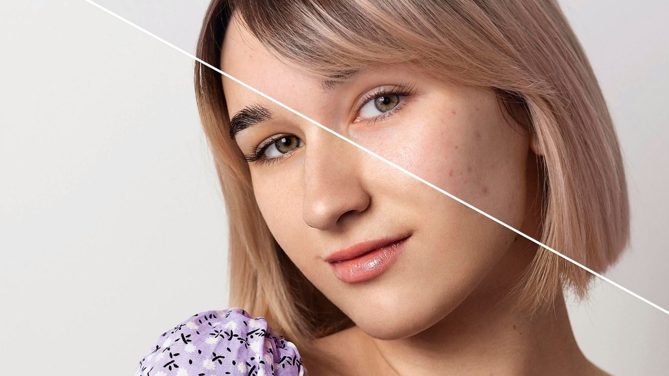 Despigmentación de la piel tratamiento: guía completa para un tono uniforme y luminoso