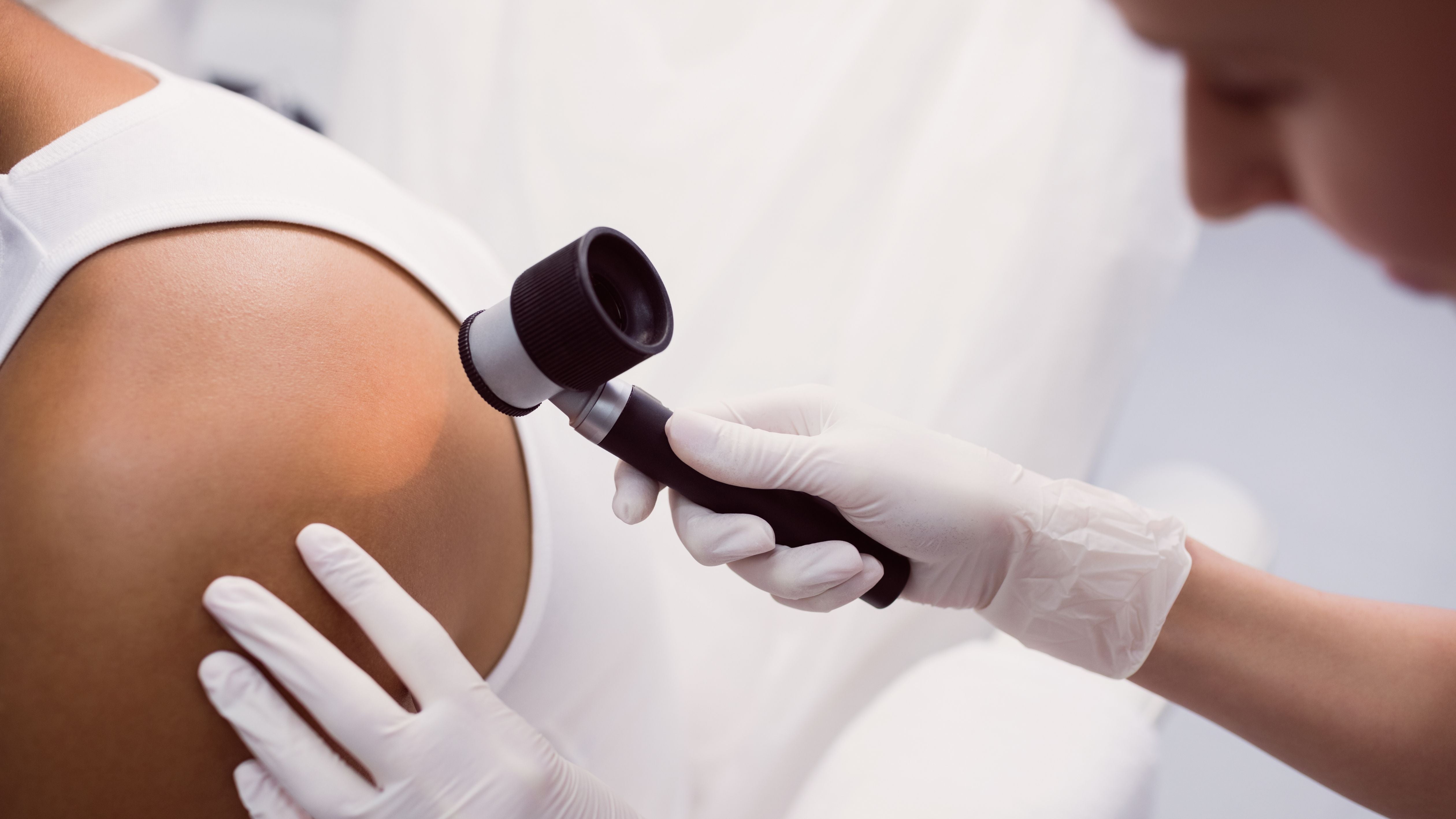 Foliculitis en piernas: tratamiento con activos, técnica de depilación correcta y cómo prevenirla definitivamente