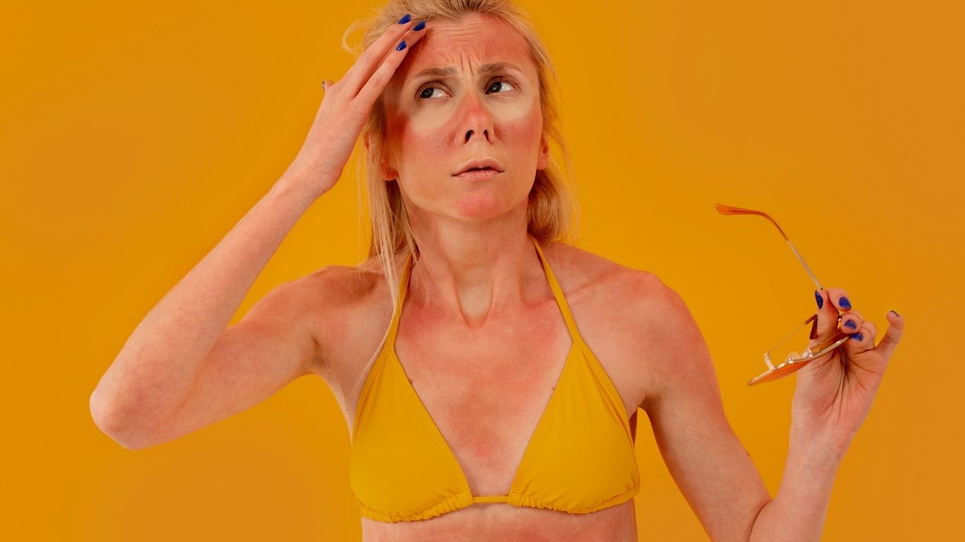 Tratamientos para aclarar piel quemada por el sol