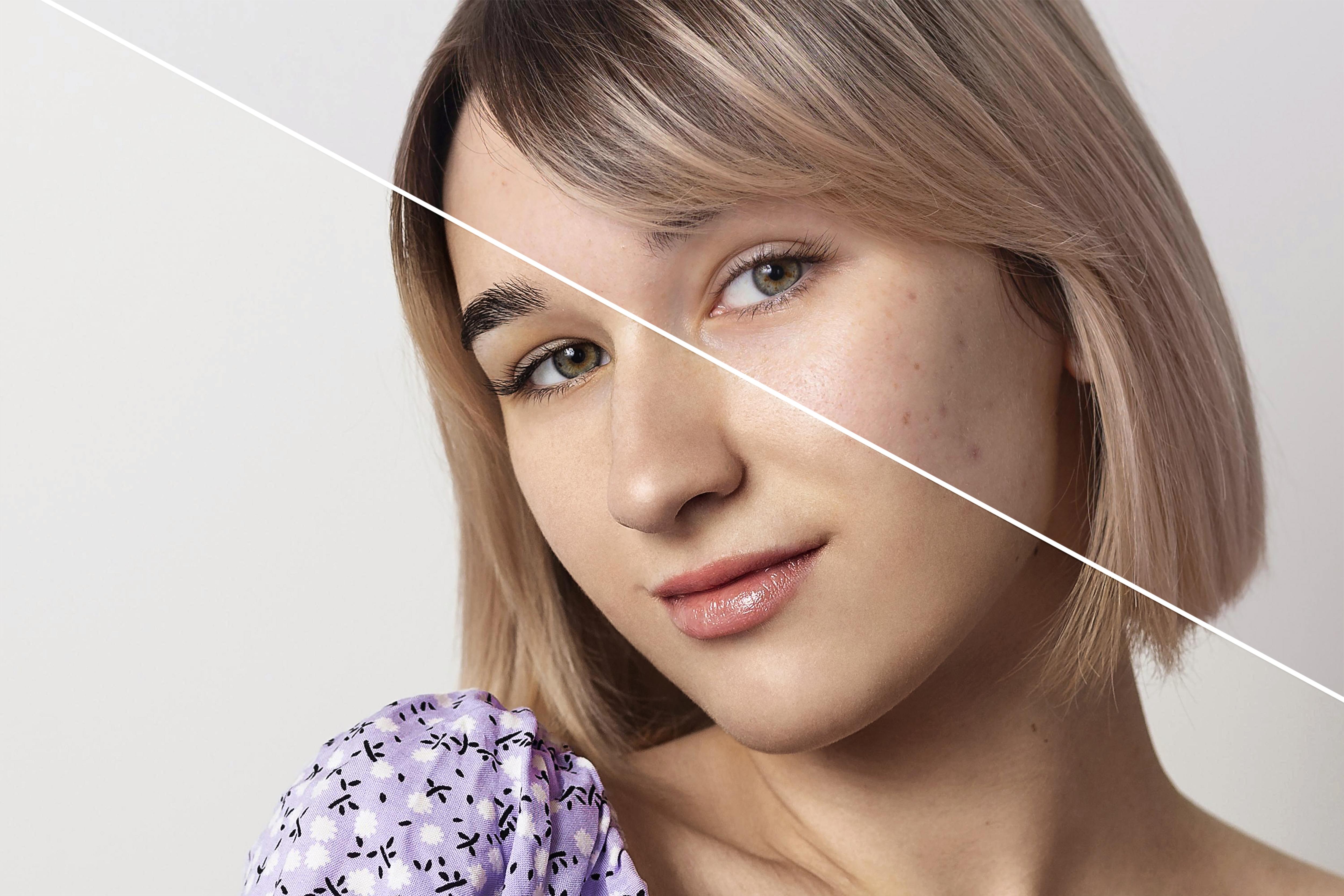 Lifting facial: opciones reales para recuperar la firmeza sin pasar por el quirófano