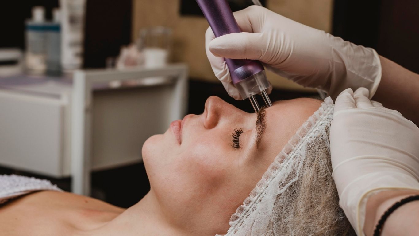 Peeling ultrasónico: qué es, cómo funciona y por qué transforma tu piel desde la primera sesión