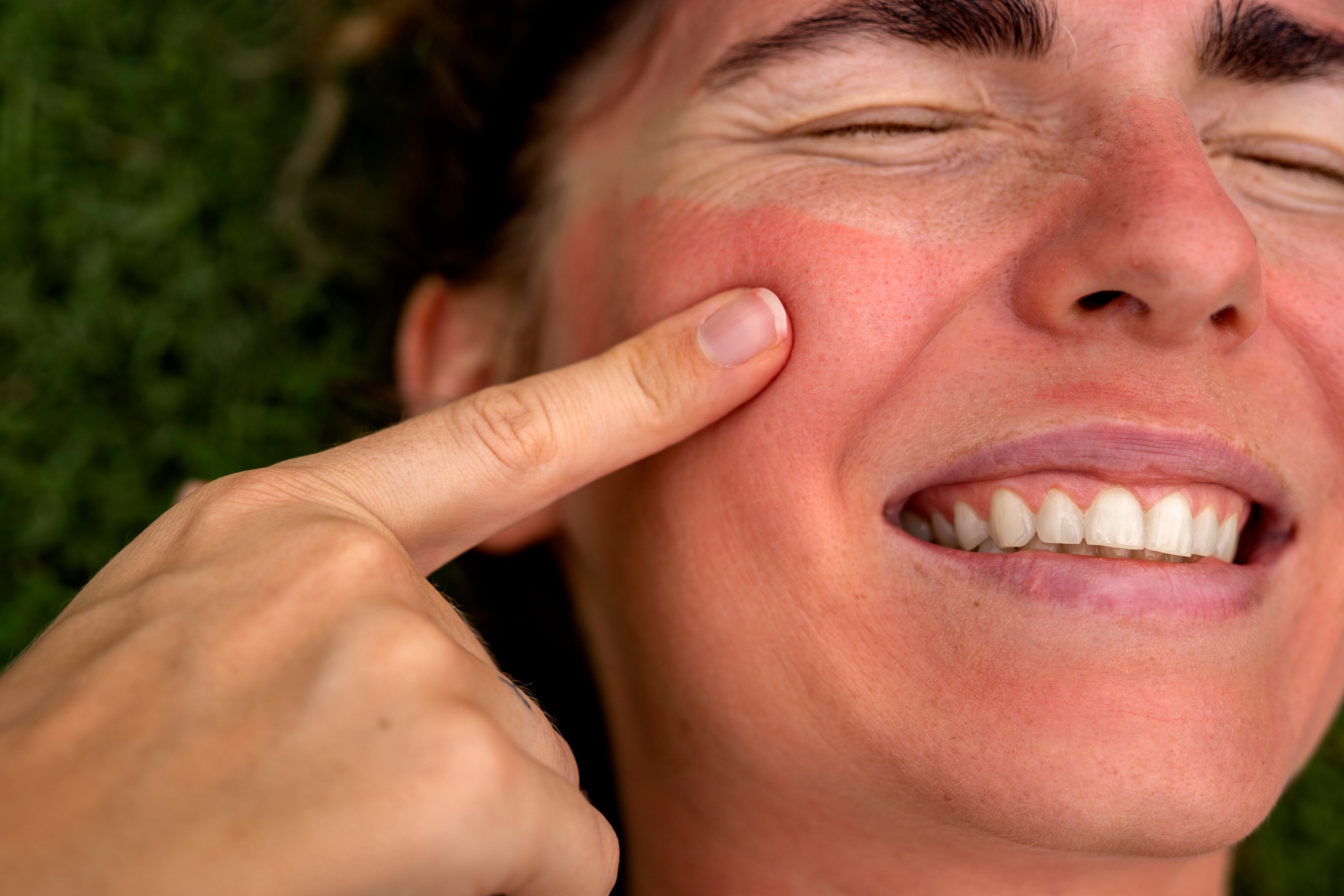 Enrojecimiento facial: causas y solución para recuperar una piel calmada y uniforme