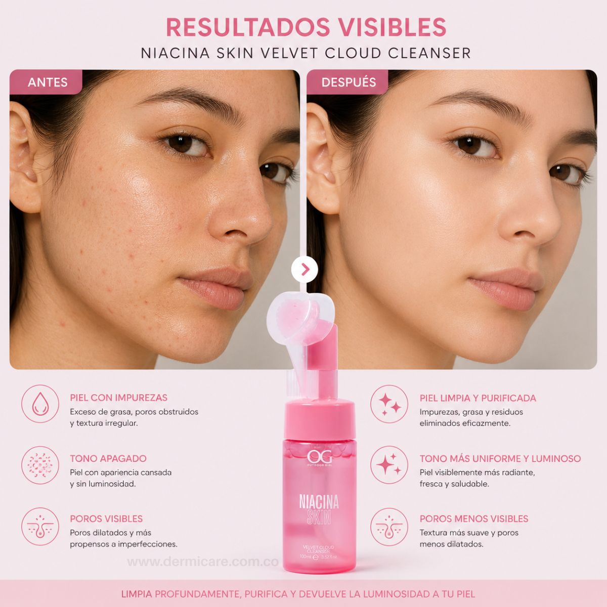 Espuma Limpiadora Niacinamida OG Colombia cleanser facial vitamina B3 poros sebo piel limpia suave