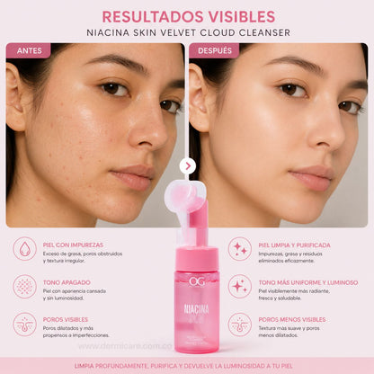 Espuma Limpiadora Niacinamida OG Colombia cleanser facial vitamina B3 poros sebo piel limpia suave