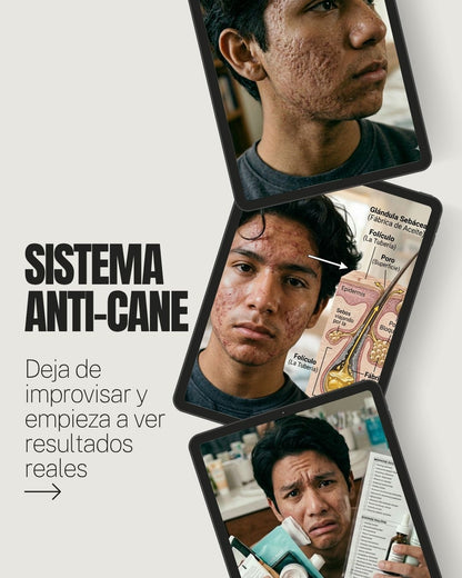 sistema antiacne rutina completa para eliminar granos y controlar grasa