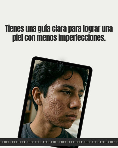 sistema antiacne rutina completa para eliminar granos y controlar grasa