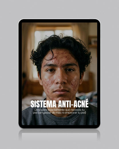 sistema antiacne rutina completa para eliminar granos y controlar grasa