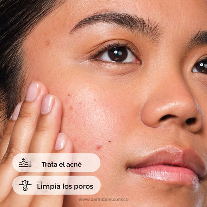 Salicylic Acid 2% Solution The Ordinary solución BHA acido salicilico poros acne control